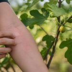 Allergies figuier : causes, symptômes et précautions au jardin