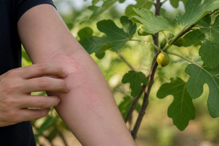 Allergies figuier : causes, symptômes et précautions au jardin